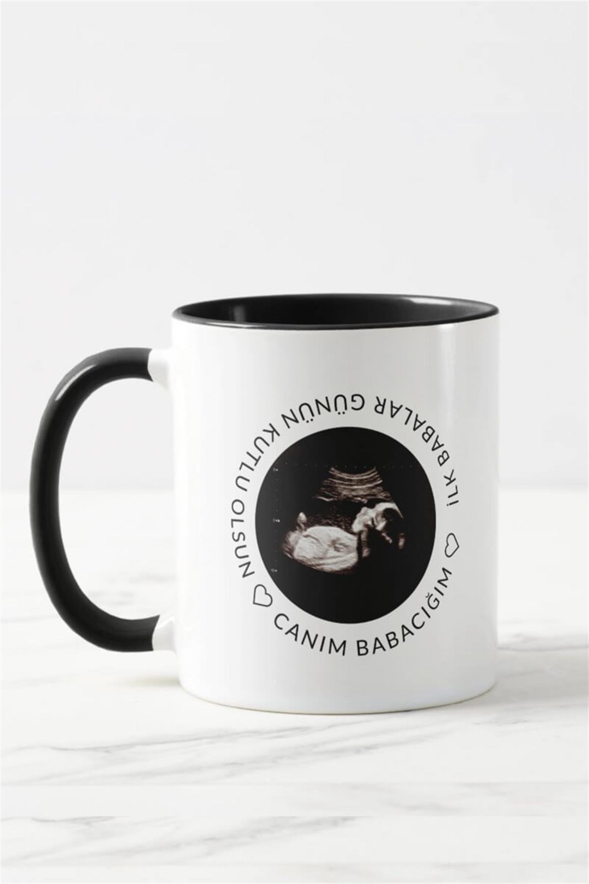 Baba Adayına Babalar Günü Hediyesi Ultrason Fotoğraflı Renkli Kupa Bardak