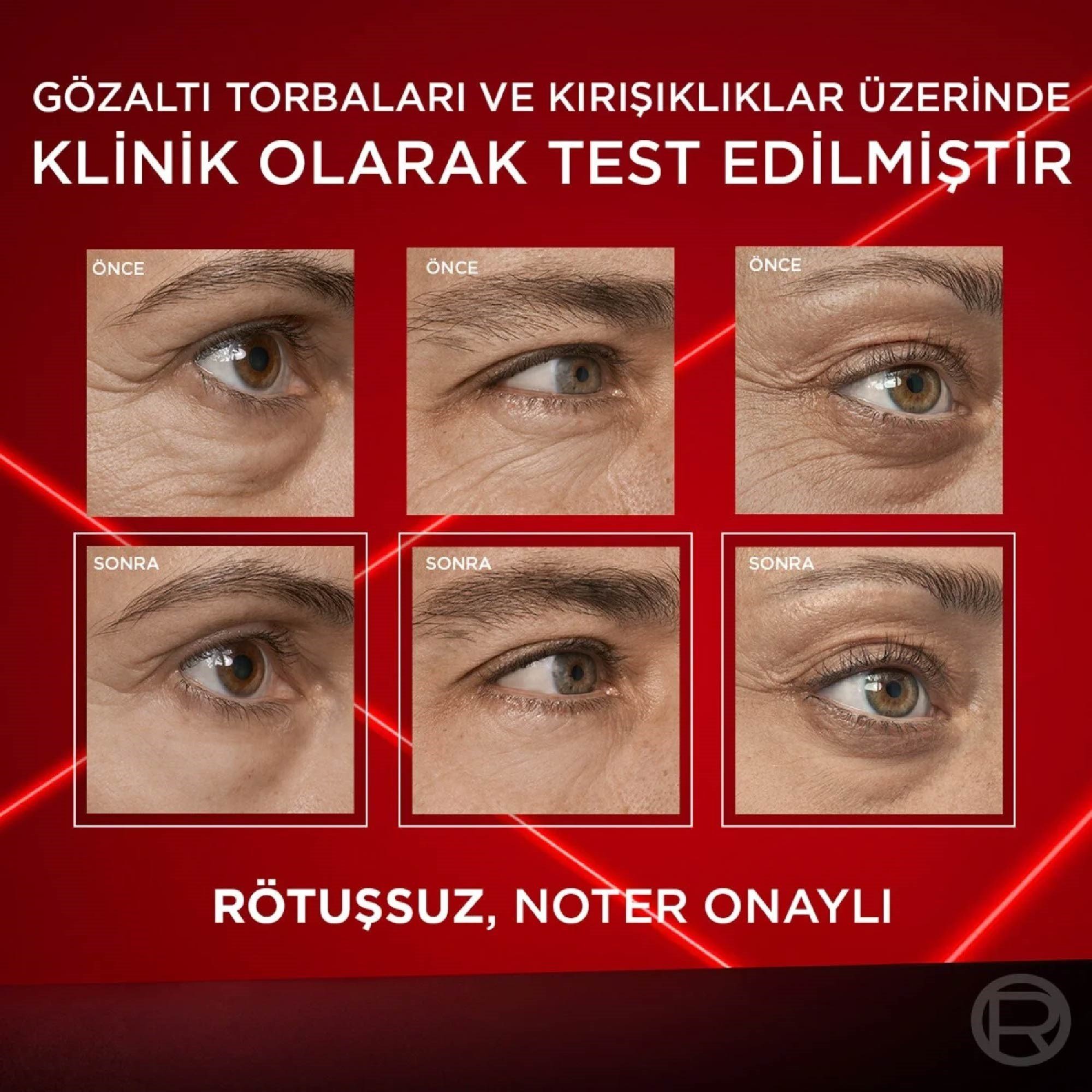 Loreal Paris Revitalift Lazer Eyebag Göz Kremi Göz Altı Torba Görünümüne Karşı Etkili 15 ml