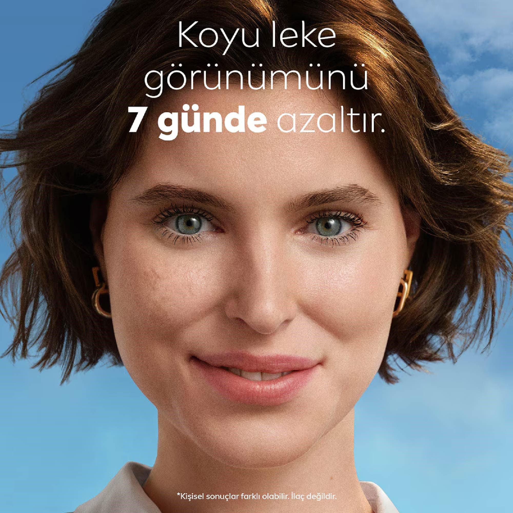 Nivea Cellular Luminous630 Antispot Leke Giderici Serum 30ml