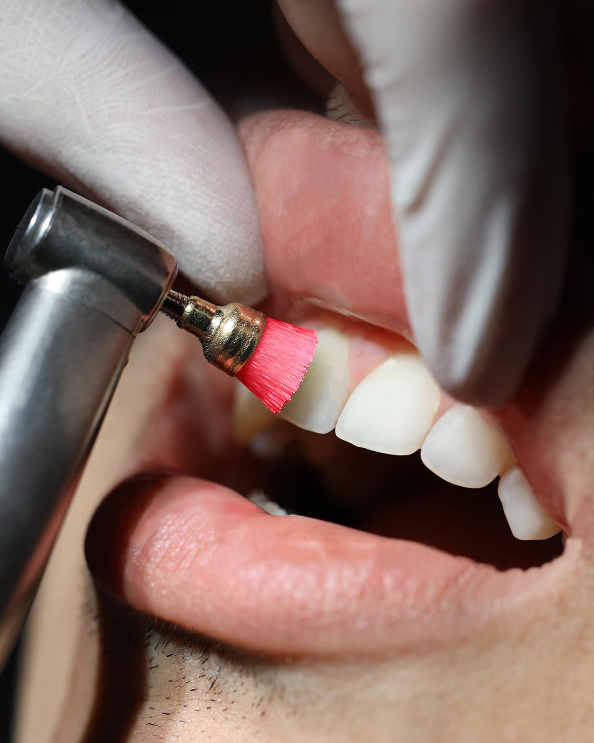 Mavi sert (Sertlik:4) polisaj fırçası 7mm