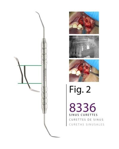 Sinüs Lifting Aleti