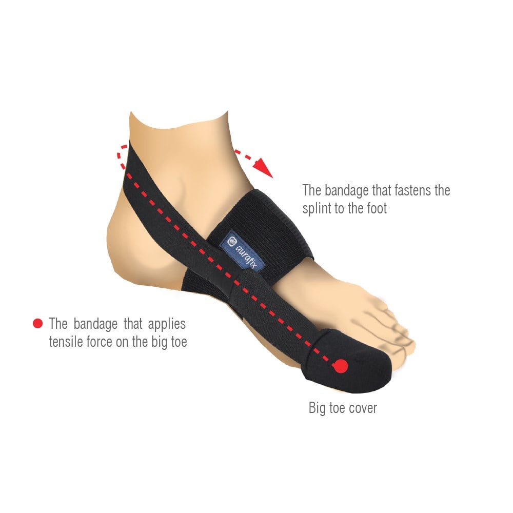 Aurafix Elastik Halluks Valgus Ateli