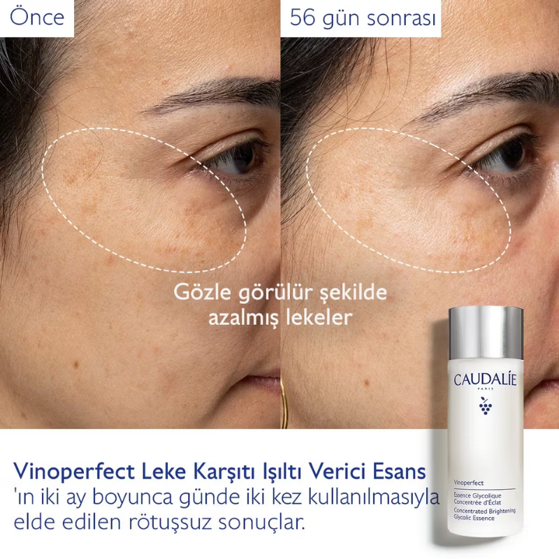 Caudalie Vinoperfect Leke Karşıtı Işıltı Verici Esans 100 ml