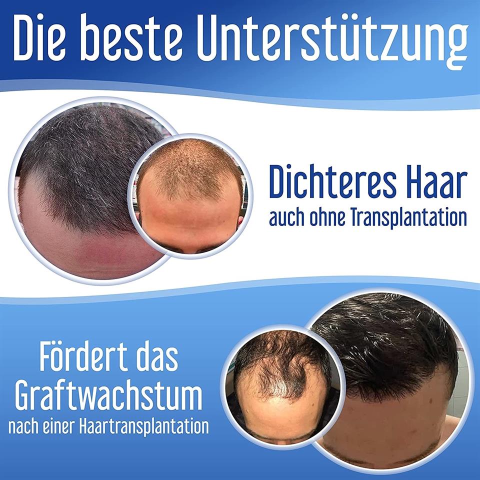 Hair Pharma Xpecia Erkek 60 Tablet
