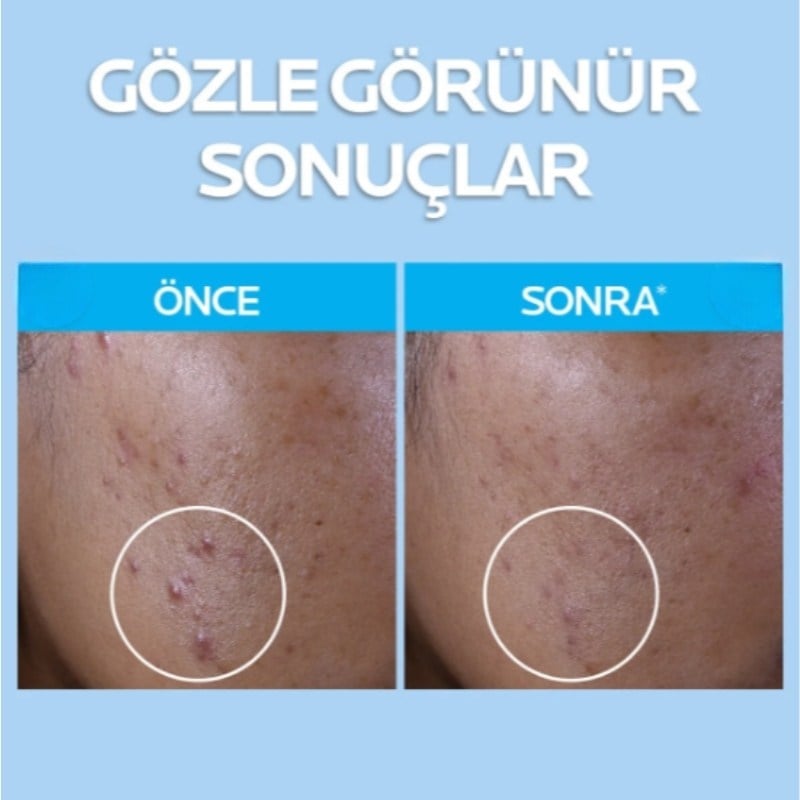 La Roche Posay Effaclar Yağlı ve Akneye Eğilimli Ciltler İçin Yüz Temizleme Jeli 400 ml X 2 Adet
