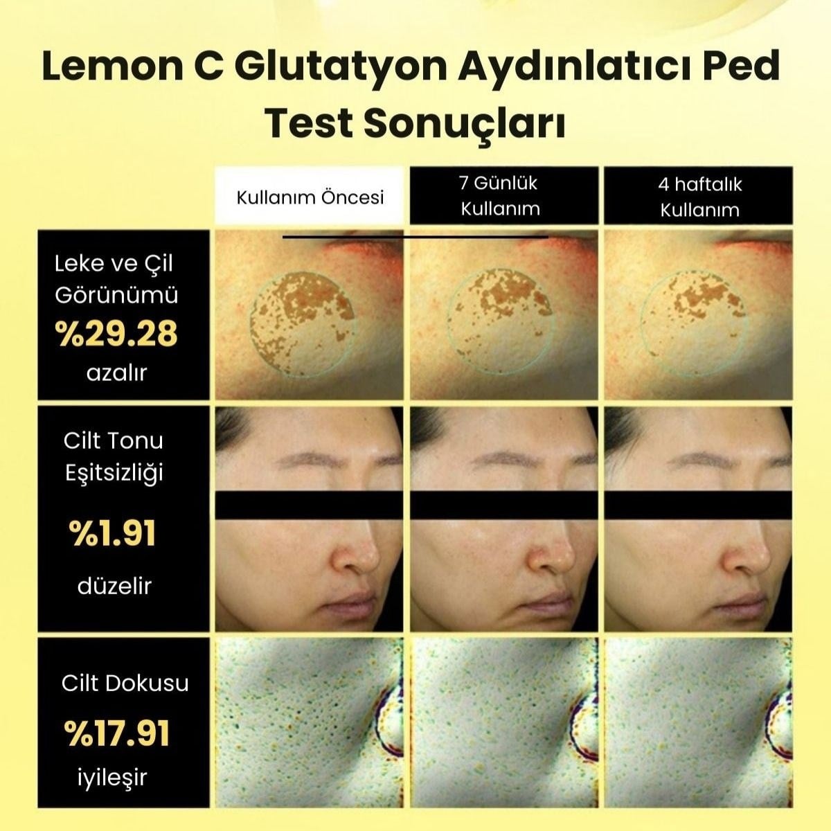 Beplain Lemon C Glutathione Brightening Pad - Aydınlatıcı Ped 70 Adet