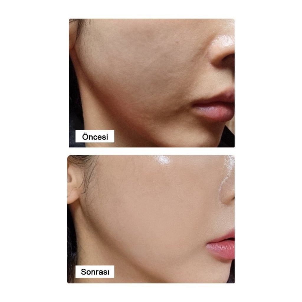 LamuCell PDRN Ampoule - Kırışıklık Karşıtı PDRN Serum 50 ml