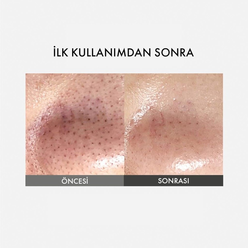 Sungboon Editor Blackhead Clear Pad - Sebum Karşıtı Temizleyici Burun Bandı 65 ad
