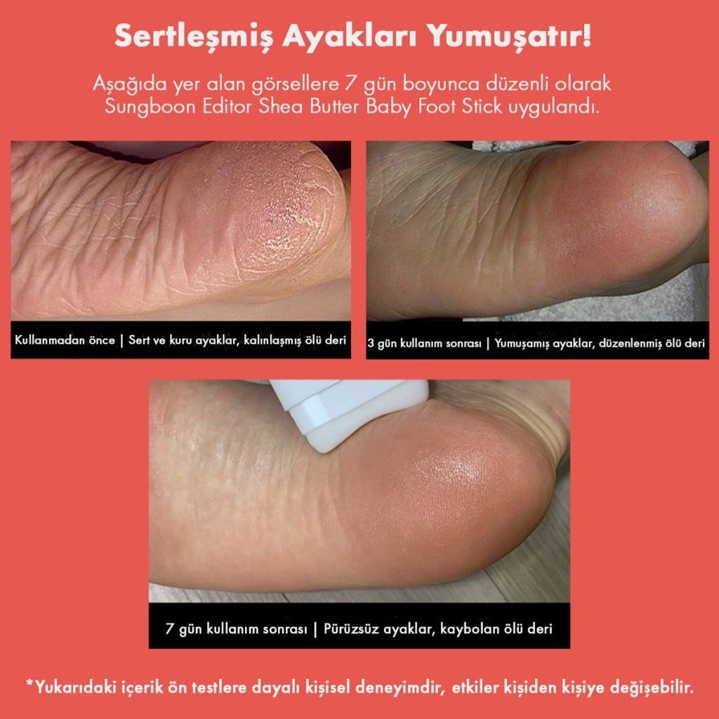 Sungboon Editor Cracked Heel Stick - Yoğun Topuk Bakım Sticki