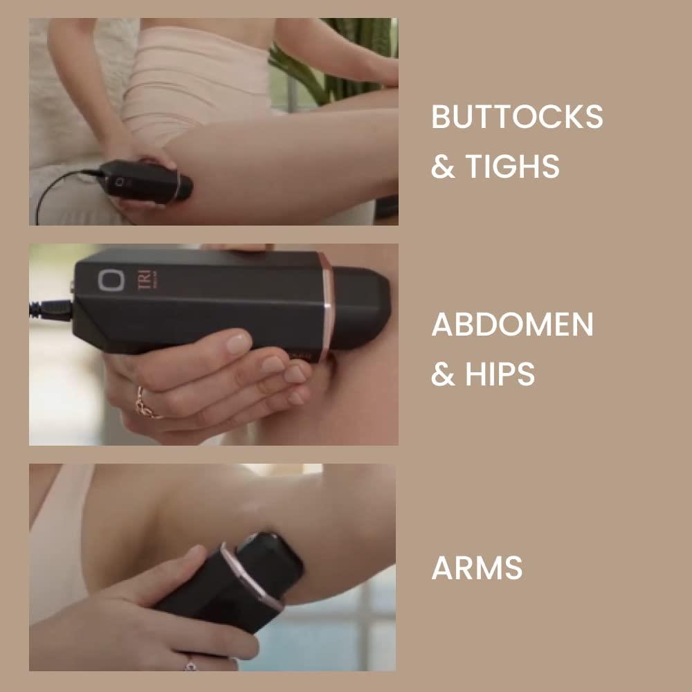 Tripollar Pose Vx Siyah Cilt Bakım Cihazı