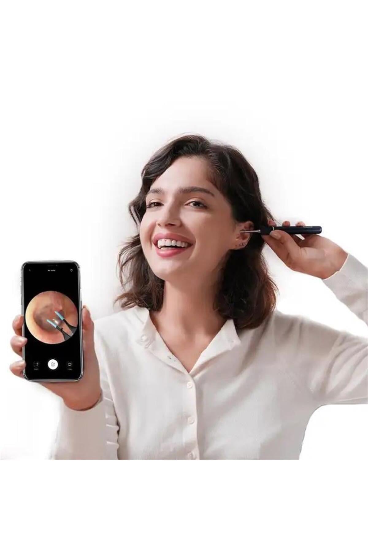 XIAOMI BEBIRD NOTE5 10MP PIXEL LENS ROBOTIC BASLIK SARJLI WIFI GORUNTULU KULAK TEMİZEYECİ ( 6 ADET BASLIK DAHİL )