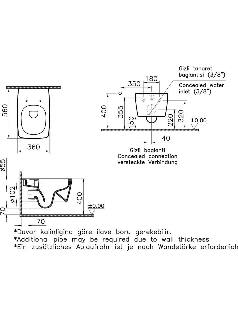 Vitra Metropole Asma Klozet Mat Siyah + Kapak