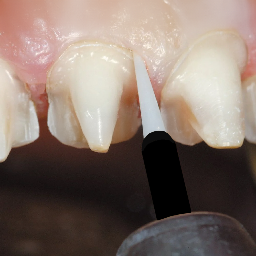 ASİDENTDENTAL STUDİO6360Zirconia TISSUE TRIMMER KIT (6ea) ZİRKON DİŞ ETİ FREZİ SETİ