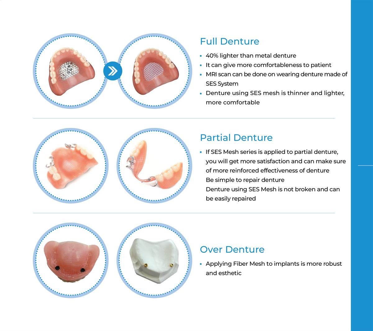 ASİDENTİNODSES LOWER MESHINNODENT SES LOWER MESH ALT PROTEZ İÇİN CAM FİBER ŞERİT (3 ADET)