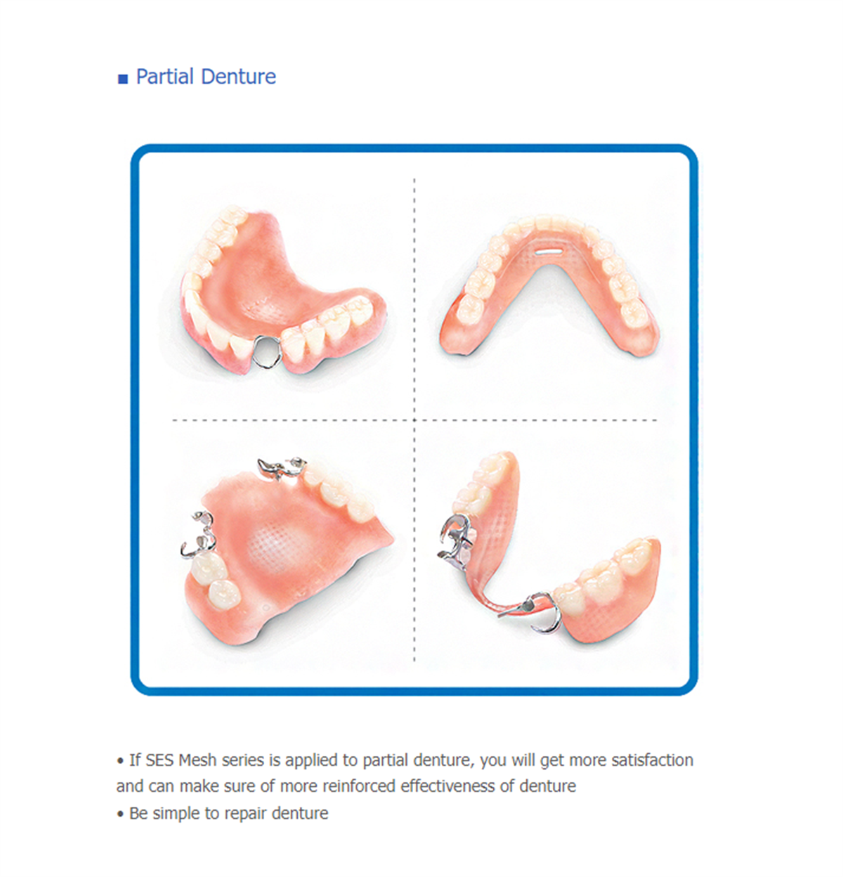 ASİDENTİNODSES MESHINNODENT SES MESH CAM FİBER KAFES 7 CMX13 CM  (3ADET)
