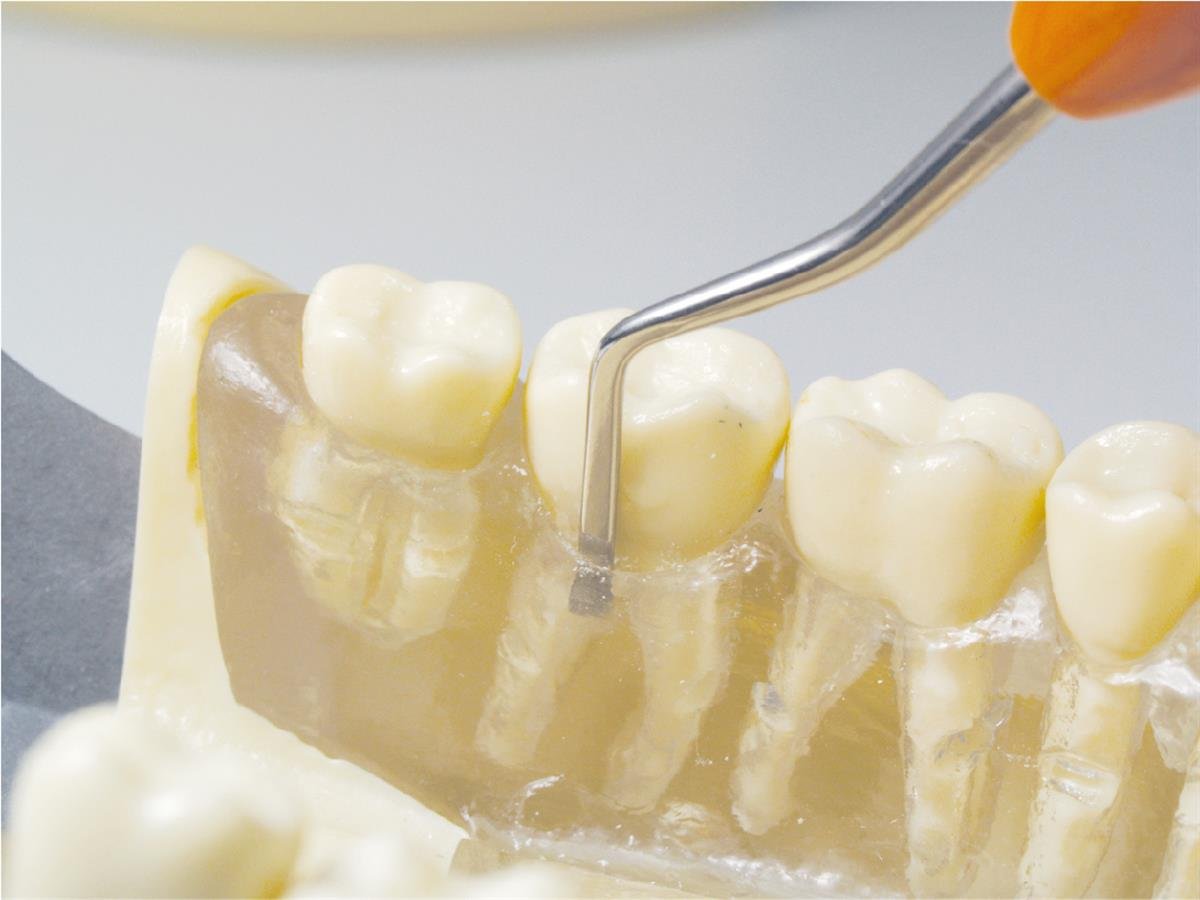 ASİDENTOSUNG(HSL34-35)(HSL34-35) KESKİ (HOE SCALER)