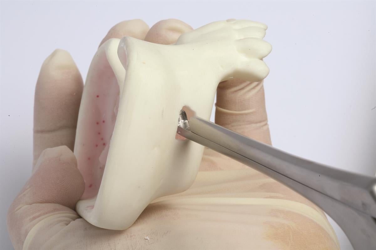 ASİDENTOSUNG(RNGSK100)(RNGSK100) Sinus Rongeur