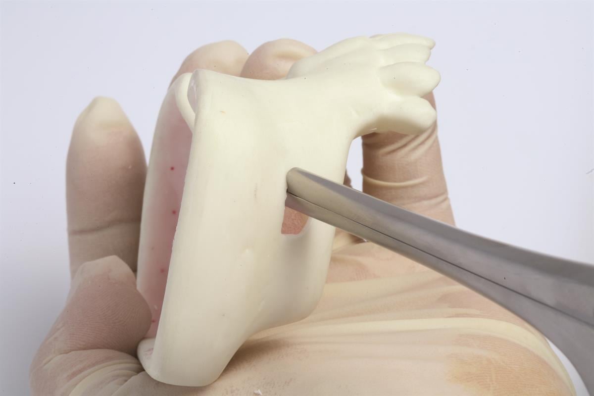 ASİDENTOSUNG(RNGSK100)(RNGSK100) Sinus Rongeur