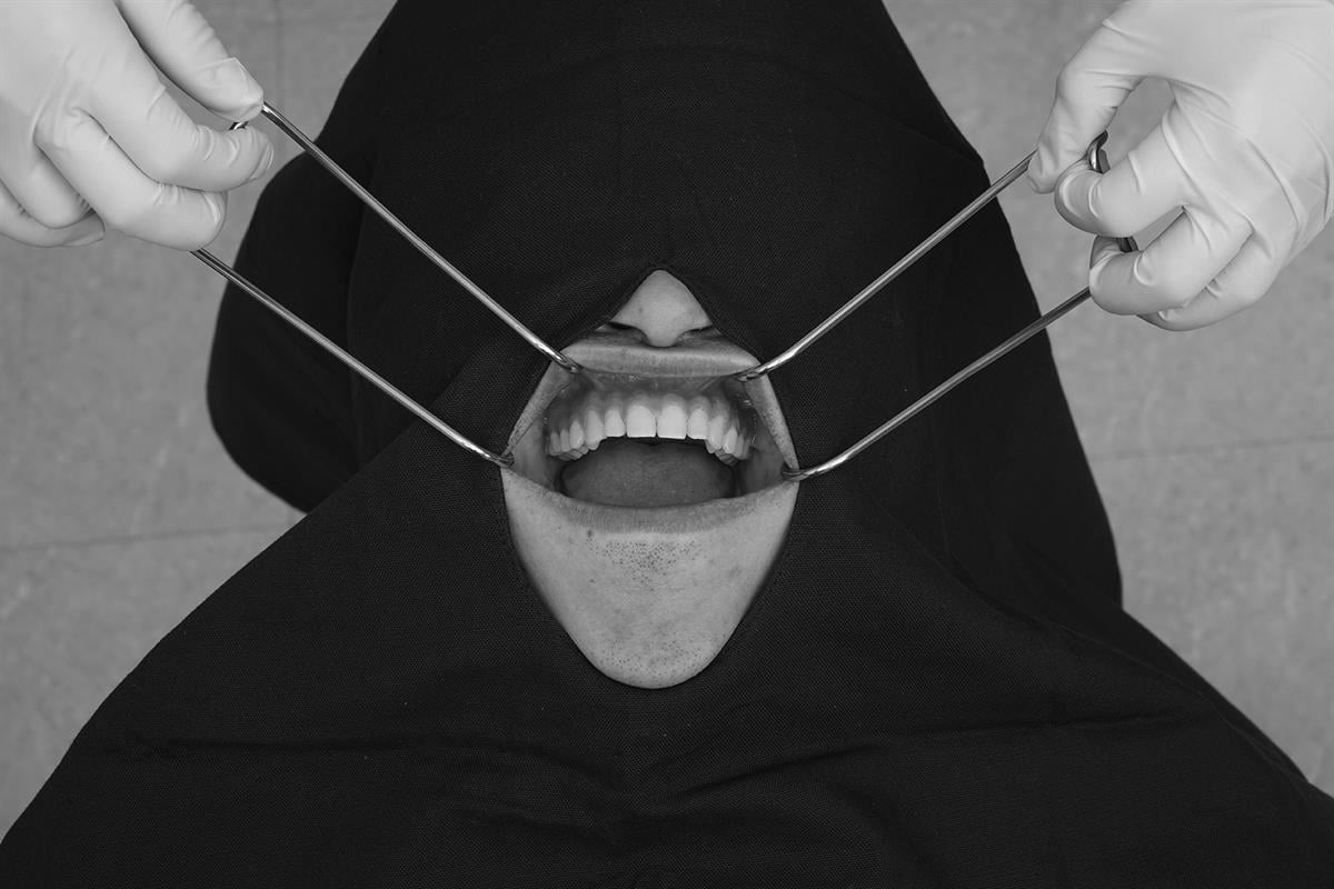 ASİDENTOSUNG(RTCRC)(RTCRC) Retractor EKARTÖR TEL