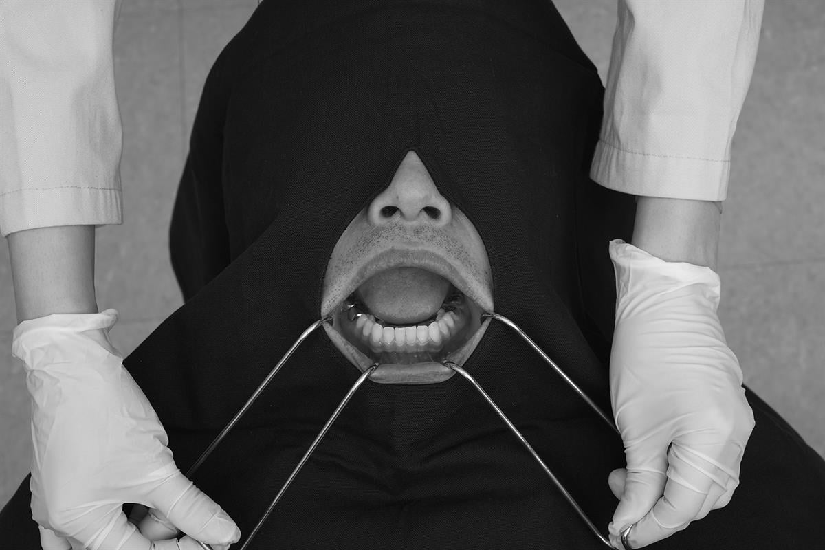 ASİDENTOSUNG(RTCRC)(RTCRC) Retractor EKARTÖR TEL