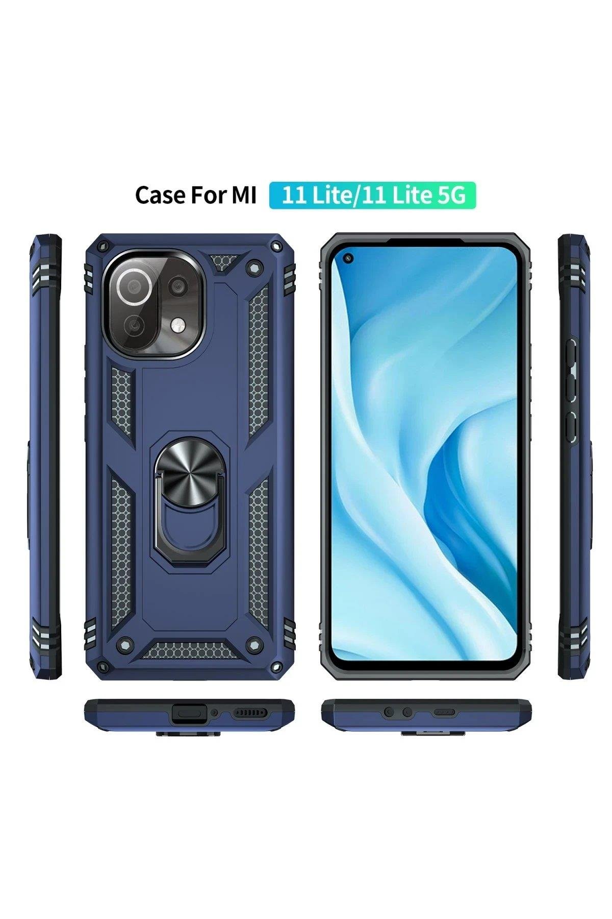 Newface Xiaomi Mİ 11 Lite Kılıf Sofya Yüzüklü Silikon Kapak - Lacivert