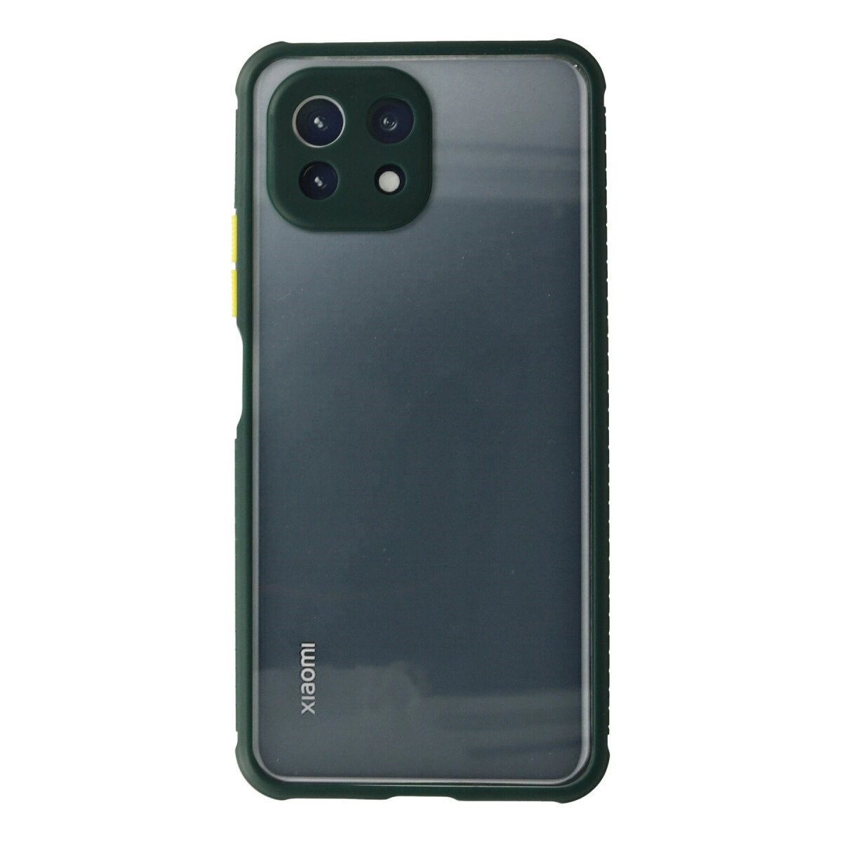 Xiaomi Mi 11 Lite Kılıf Miami Şeffaf Silikon - Koyu Yeşil