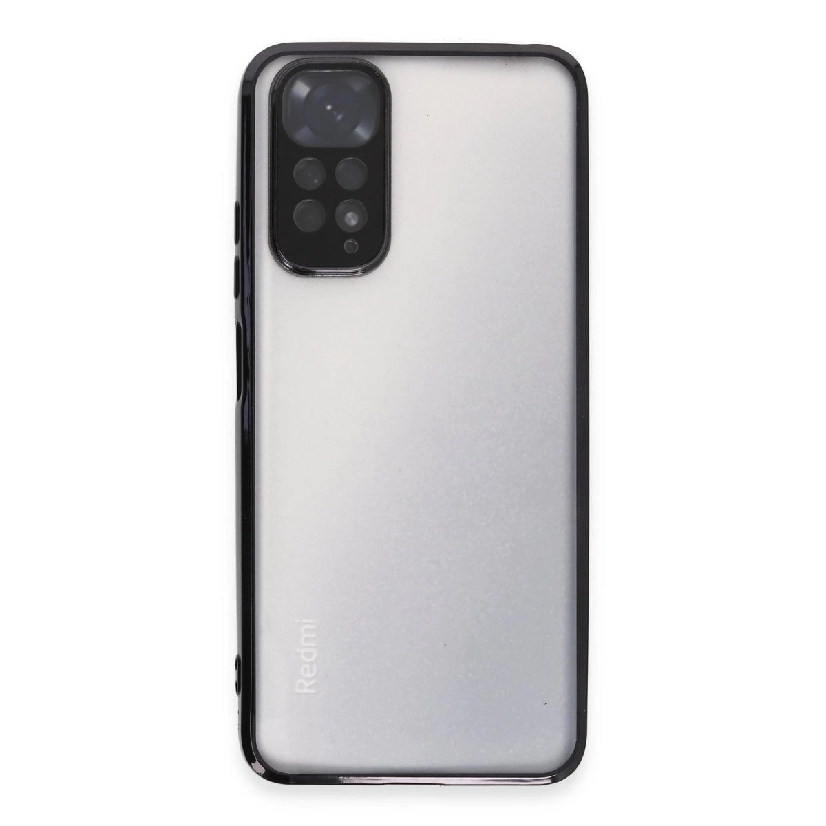 Xiaomi Redmi Note 11 Kılıf Razer Lensli Silikon - Siyah