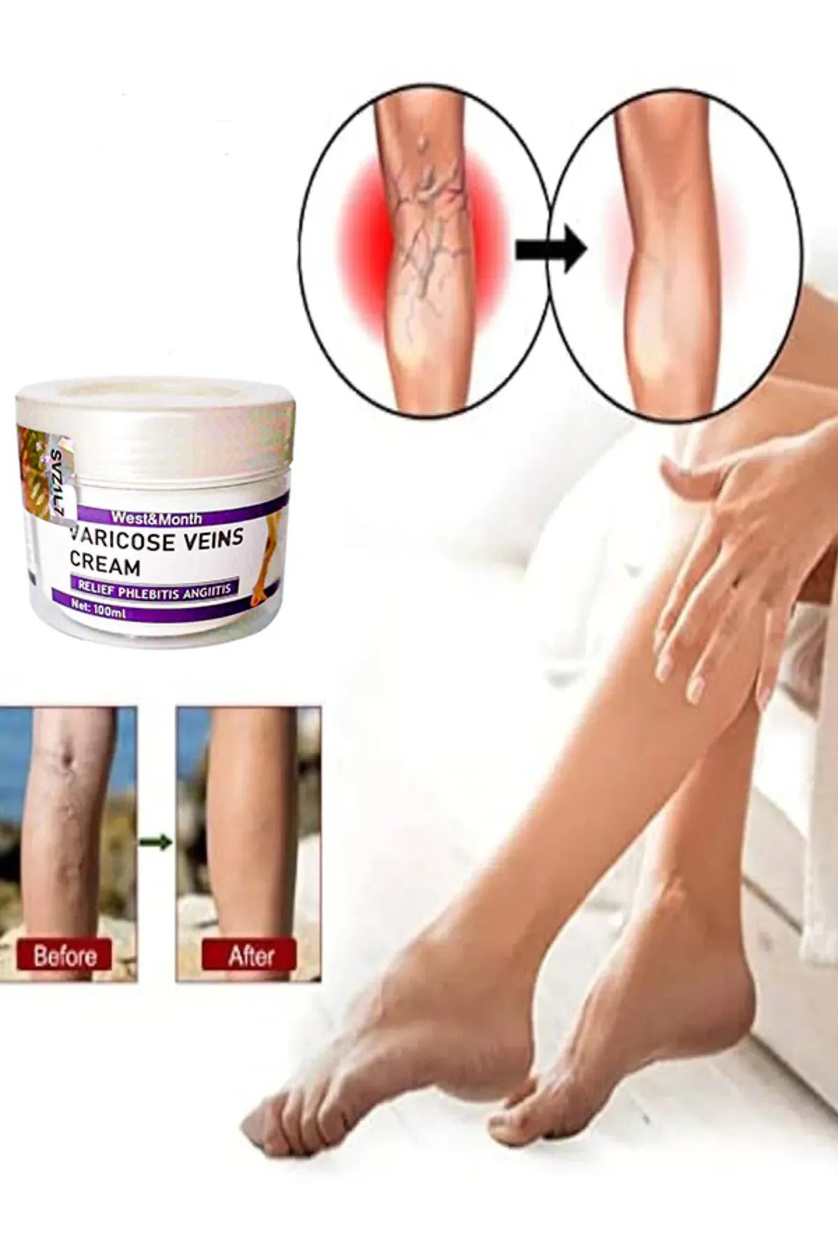 Cream West&Month Selülit Karşıtı Bacak Önleyici Bakım Kremi 100 ml X 2 ADET