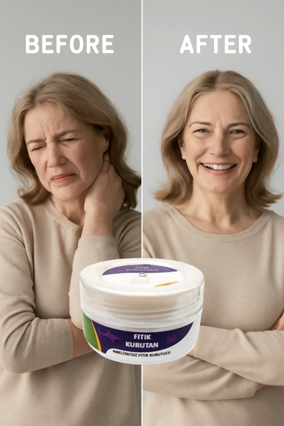 Fıtık Kurutan Krem 50 Ml