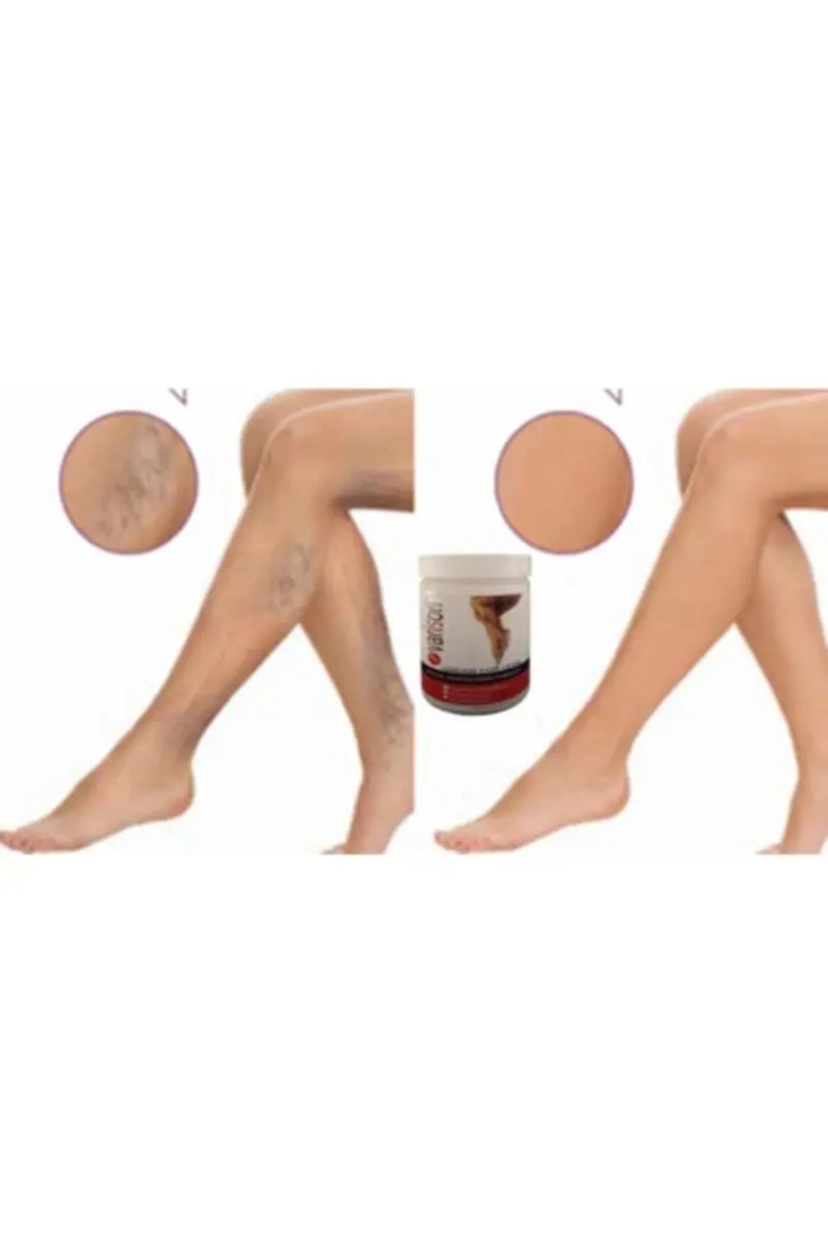 Kremi 200ML / Varison Varicose Veins Cream 200ML X 2 ADET
