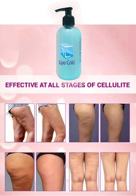 Lipo Cold Fazlalık Yağlarınızdan ve Selülitlerinizden Kurtulabilmeye Karşı Krem 250 ml