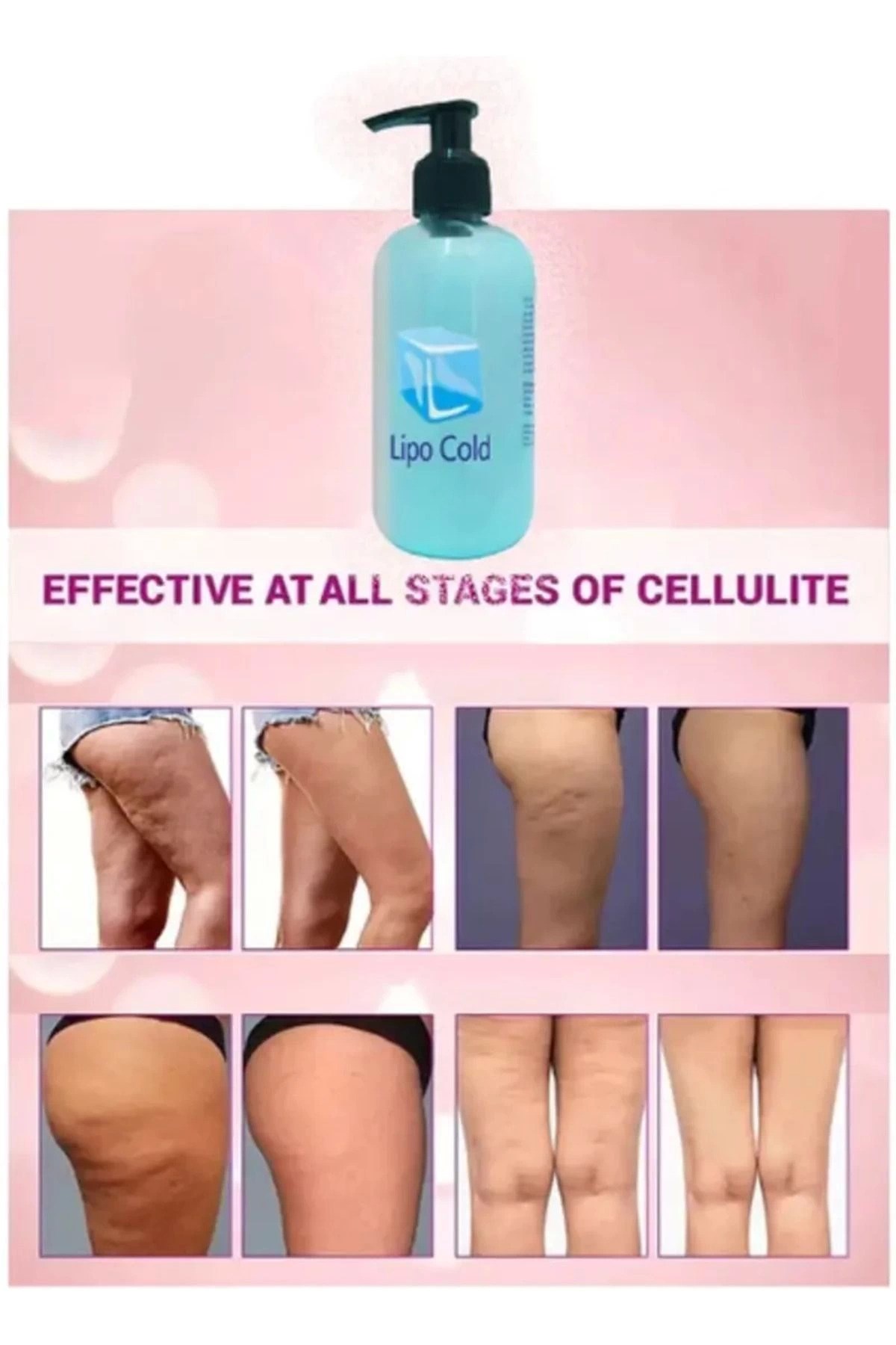 Lipo Cold Sıkılığa Inceliğe Hafifliğe Ve Selülilitlerinize Güçlü Etkide Krem 250 ml X 2 ADET