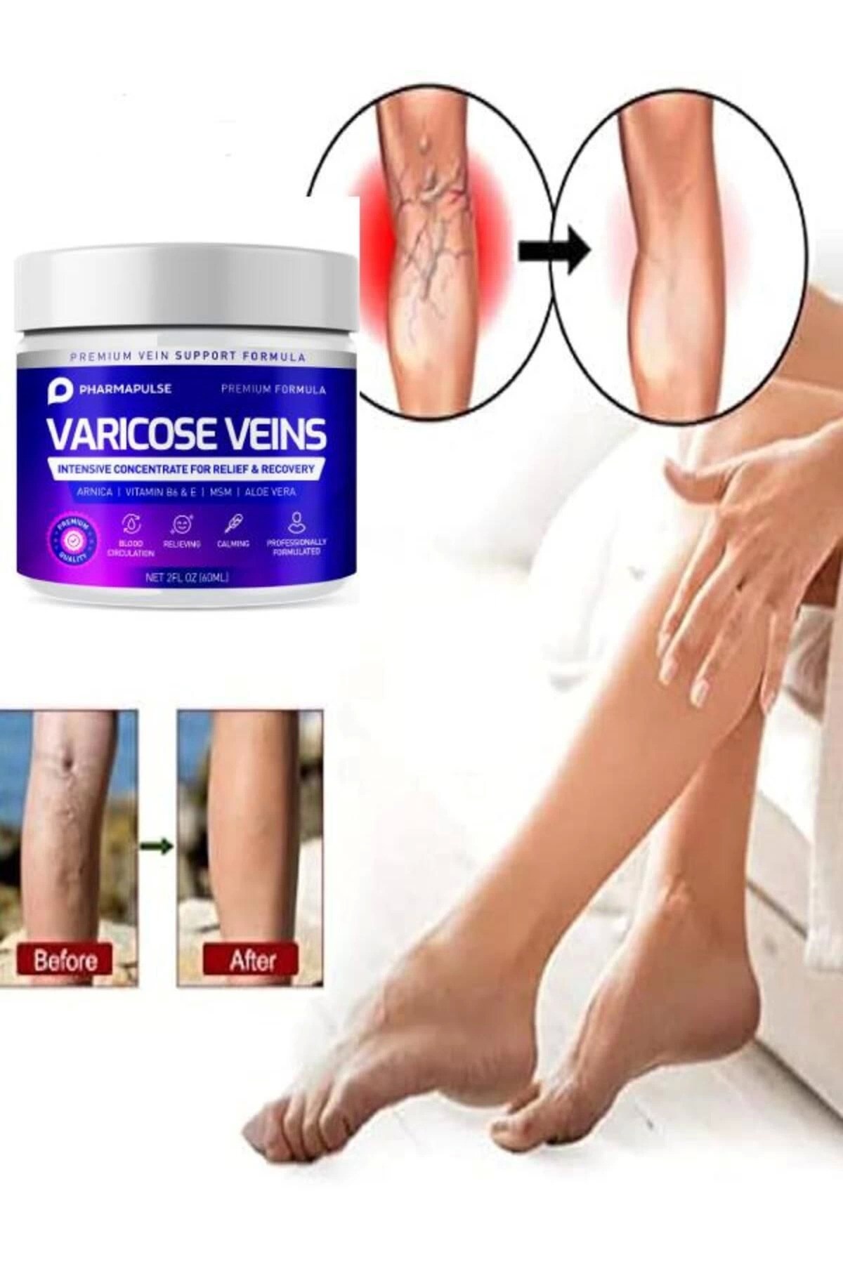 Maximum Strength Varicose Vein Var.is Bacak Bakım Masaj Kremi 100 ml