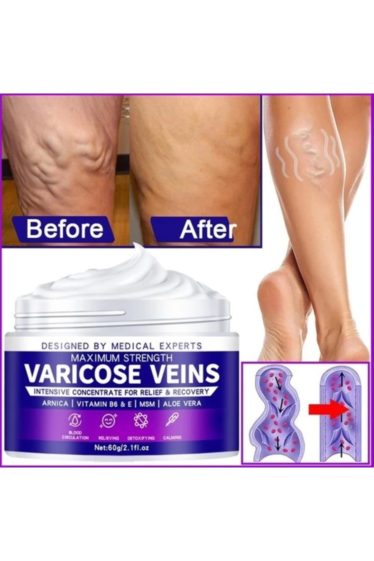Maximum Strength Varicose Veins Krem 100 ml 1 Adt