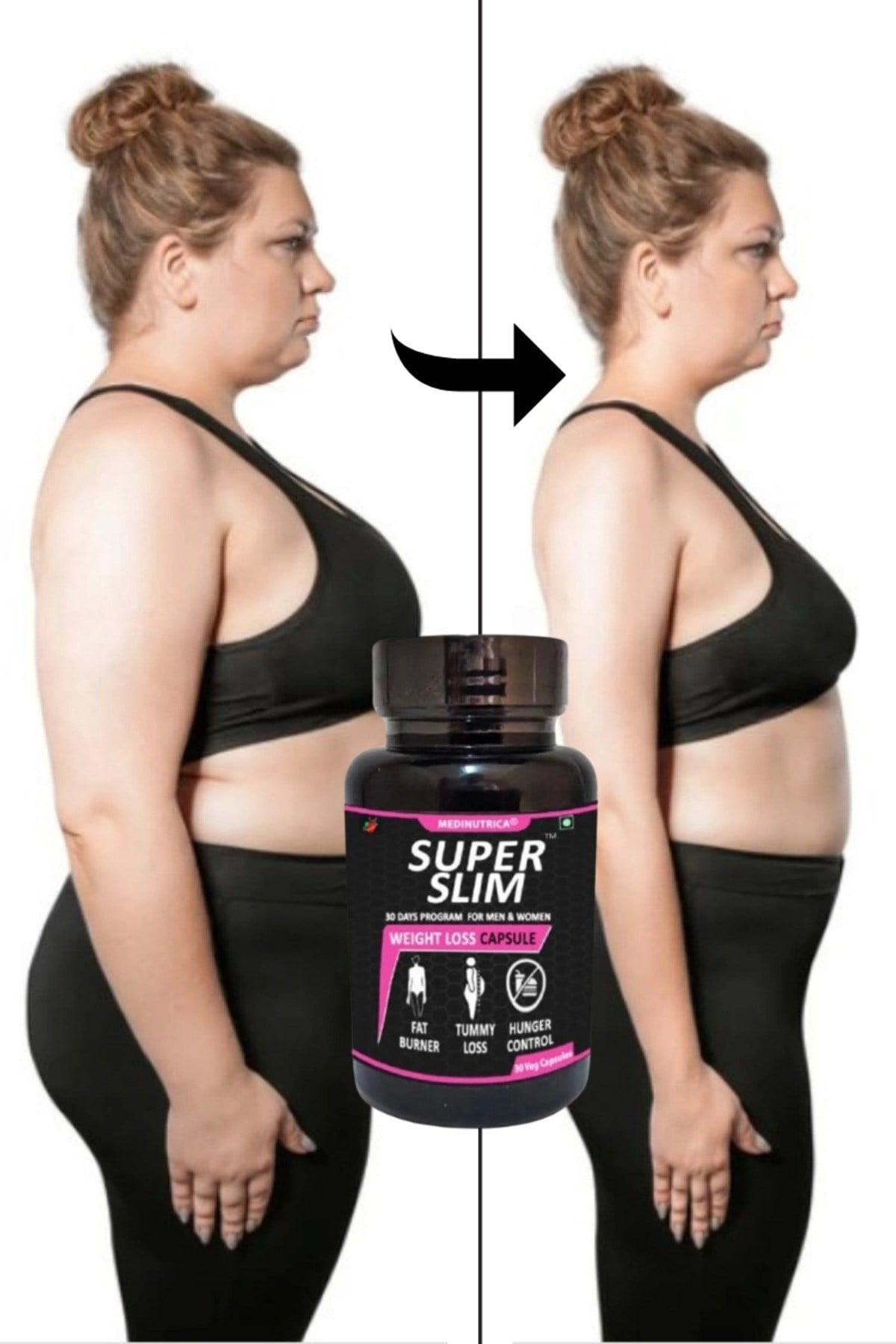 Medinutrica Super Slim Bölgesel Şekillendirici 30'lu Destekleyici Ürün