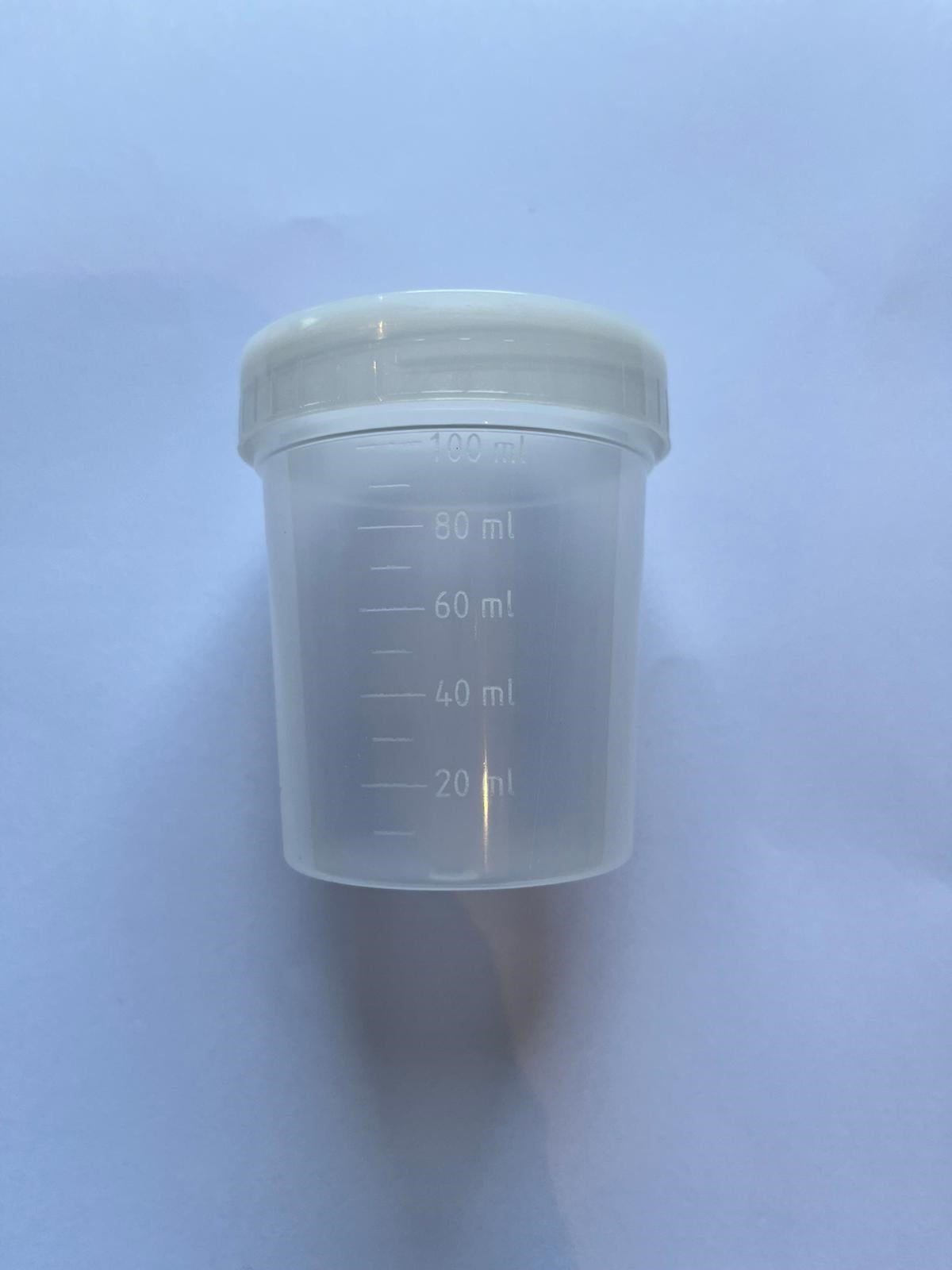 Non-Steril İdrar Numune Kabı -100 ml
