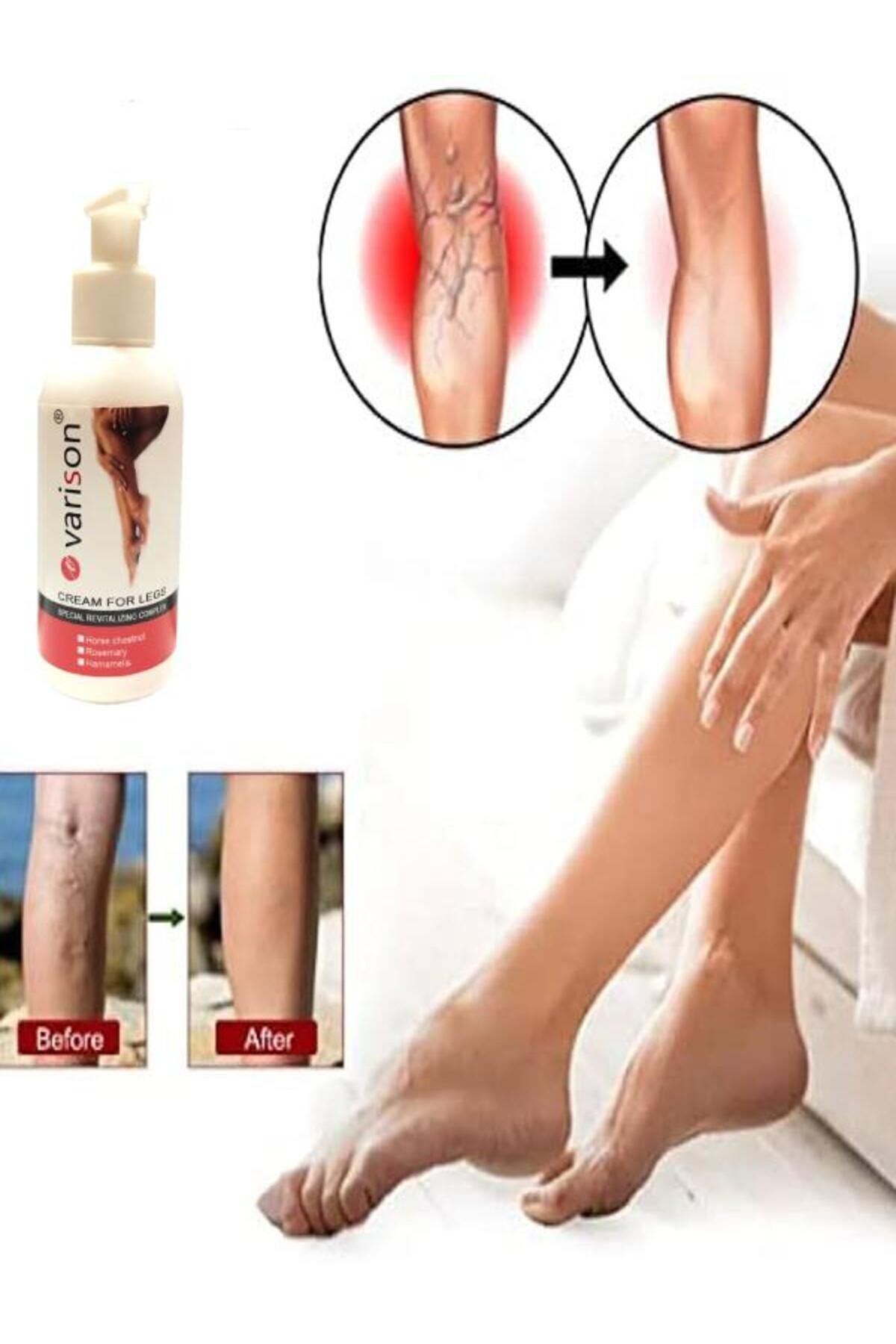 On  Sellülit Bacak Bakım Kremi 120 ml