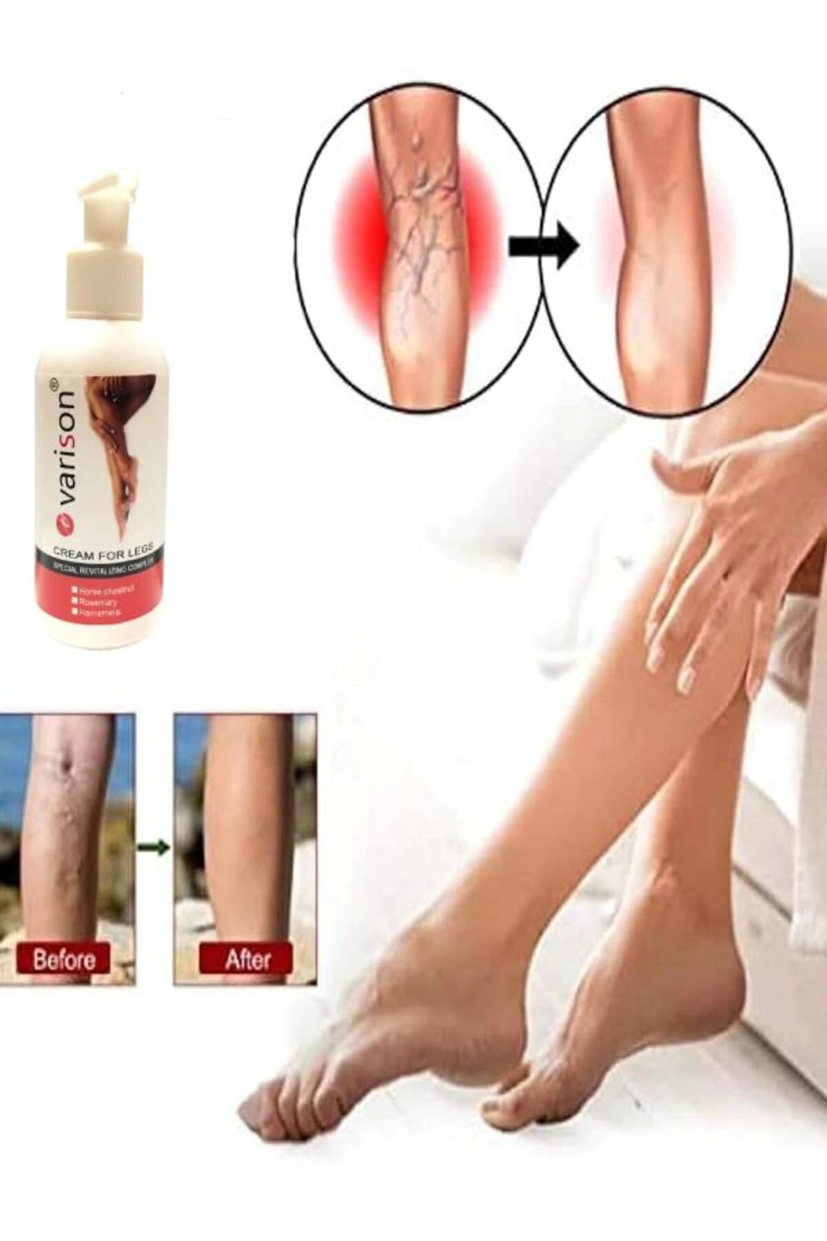 On  Sellülit Bacak Bakım Kremi 120 ml