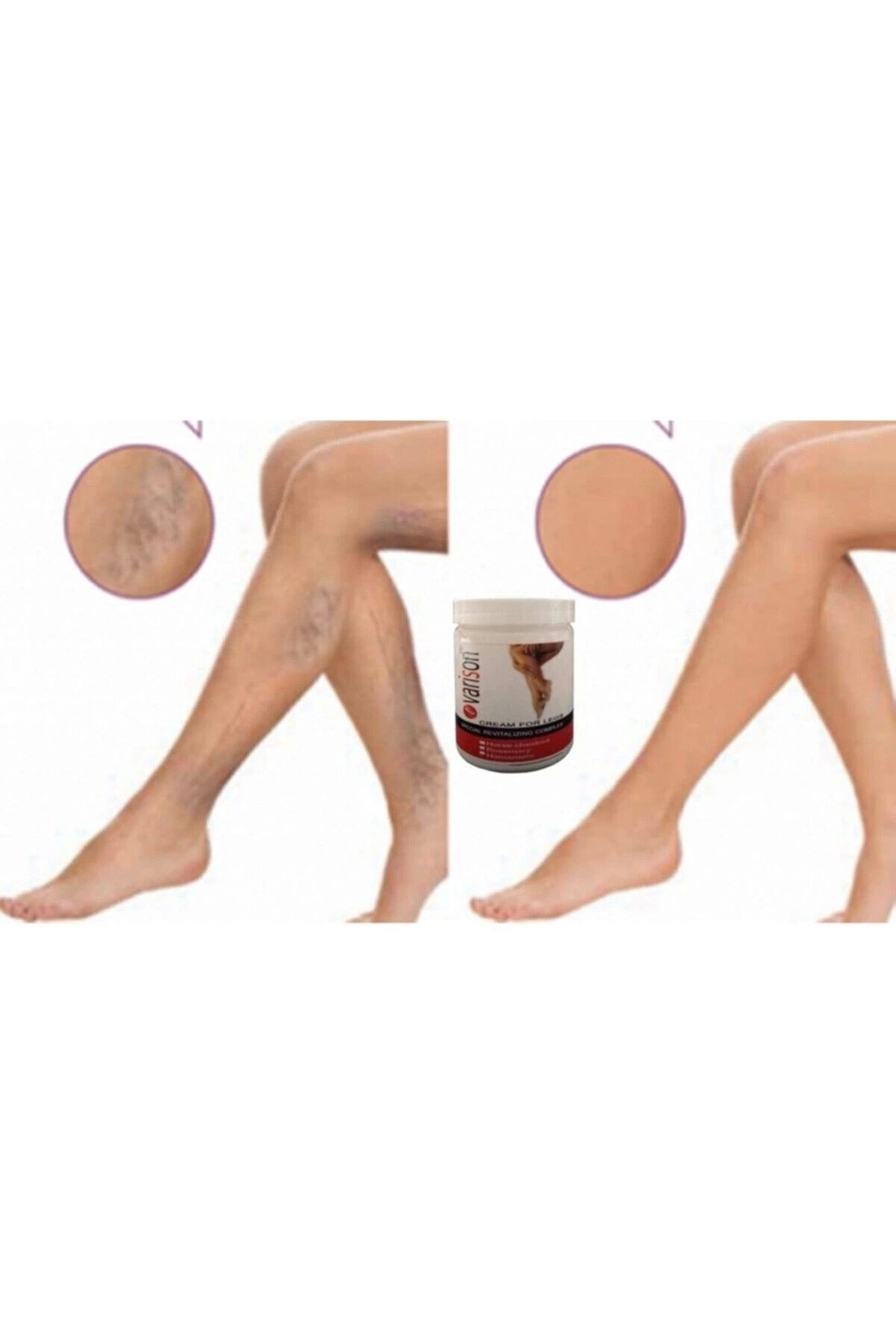 On  Selüllit Bacak Bakım Kremi 200 ml X 2adet
