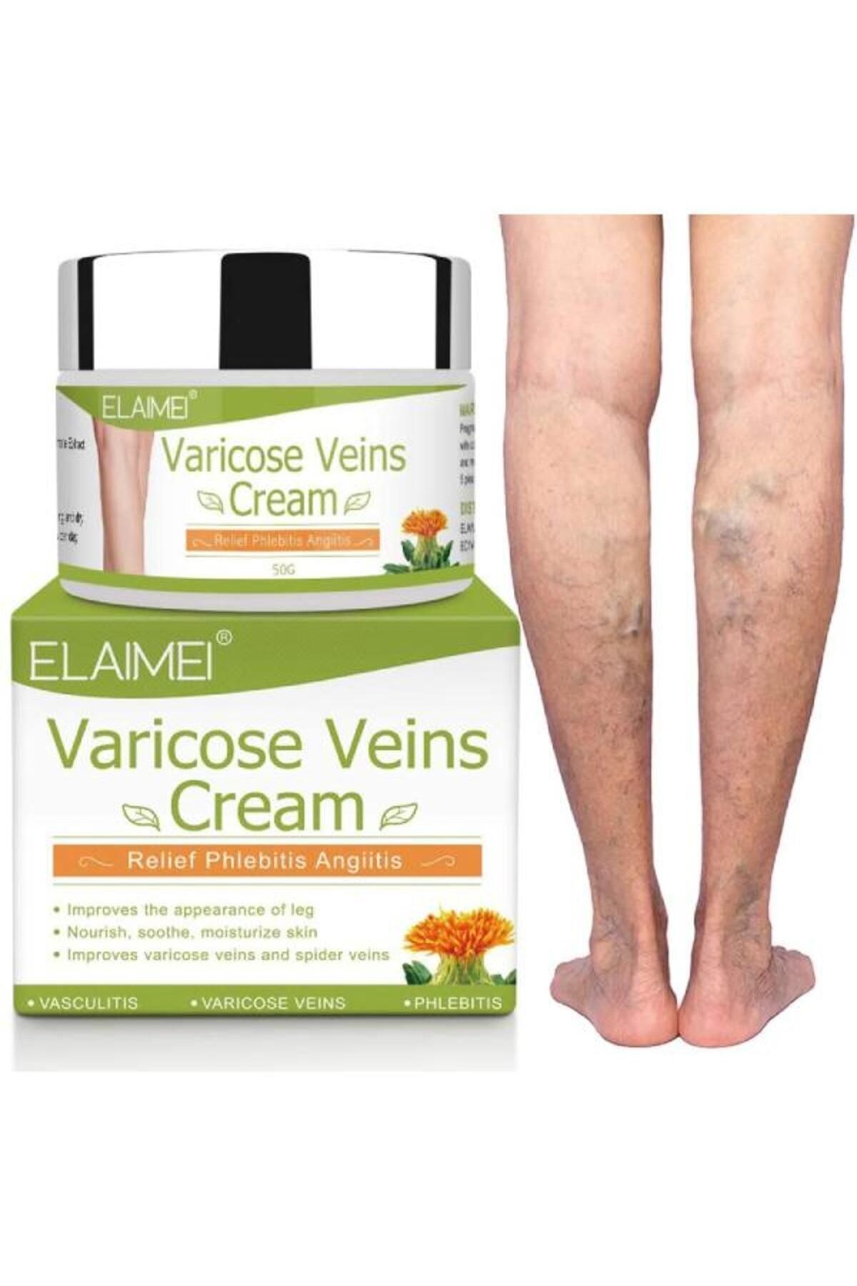 Spider Varicose Veins Var.is Diz Bacak Ayak Bakım Kremi 2 Adet X 100 ml