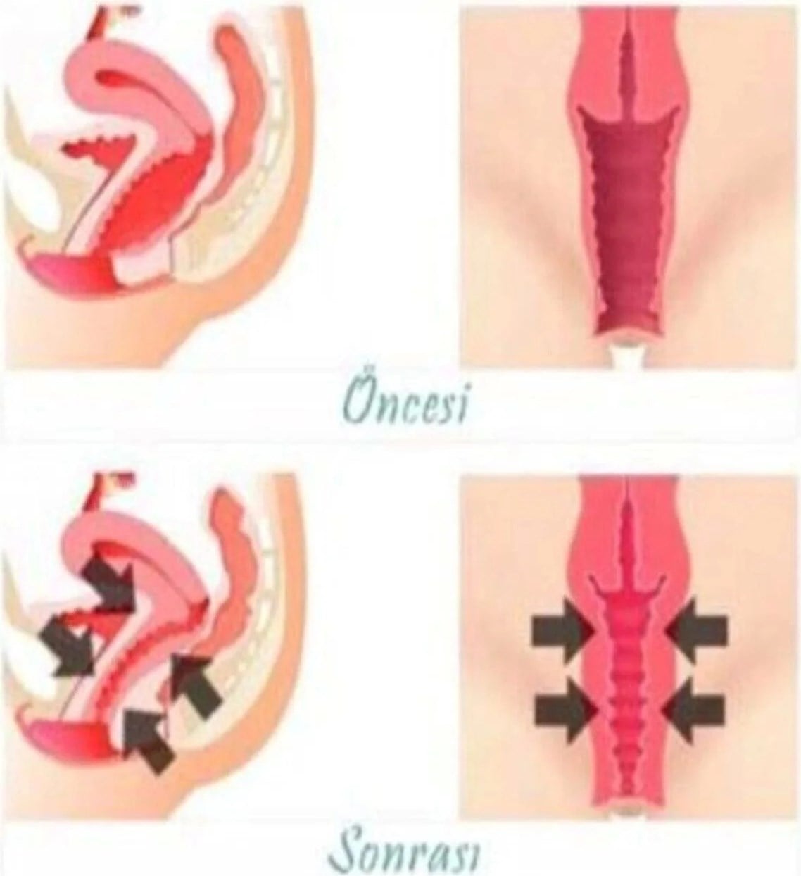 Vagitight Kadınlara Özel Genital Bölge Krem 100 ml x 3 Adet