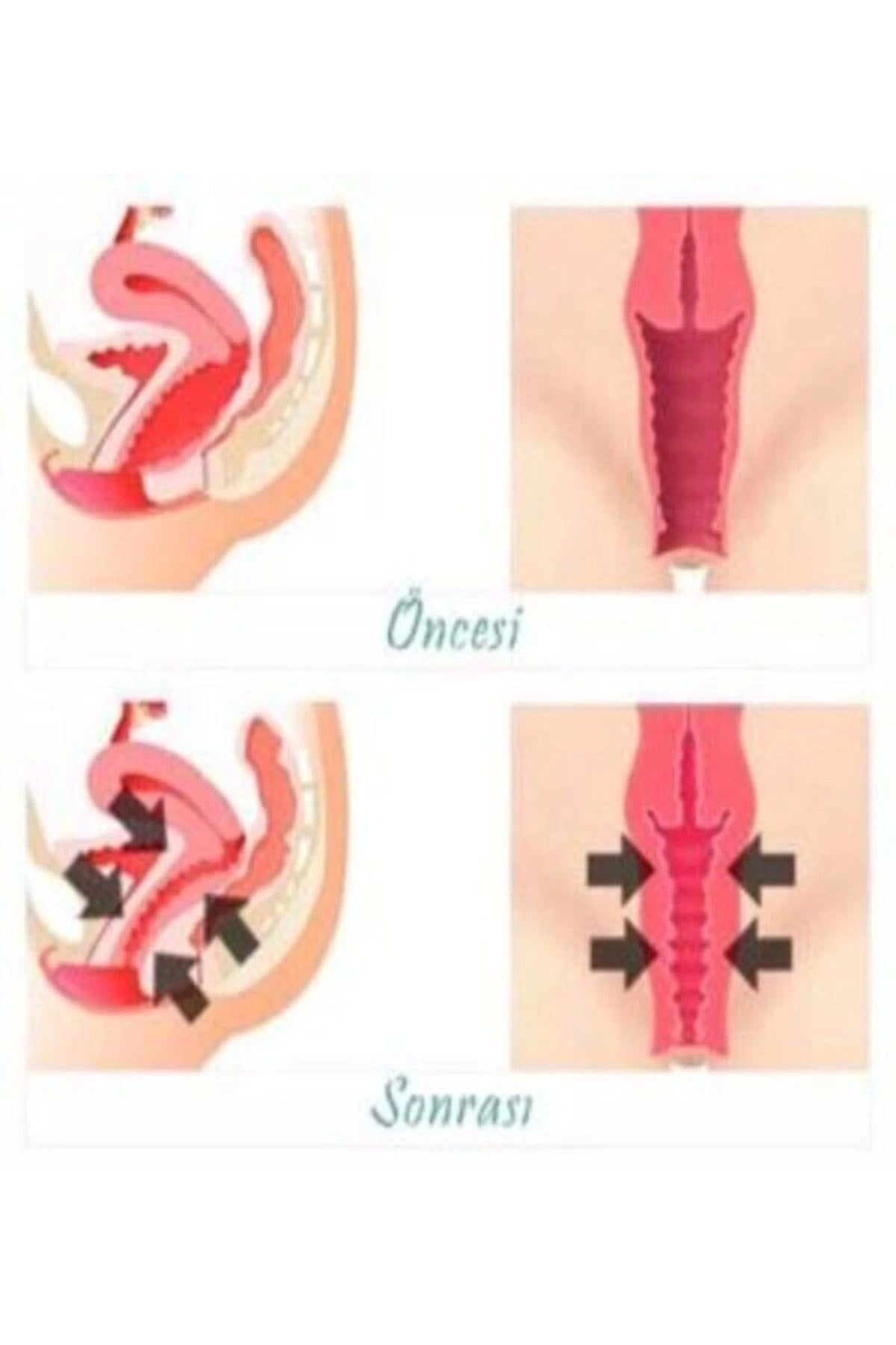 Vagitight Kadınlara Özel Genital Bölge Şekillendirici Krem 100 ml X 3 ADET