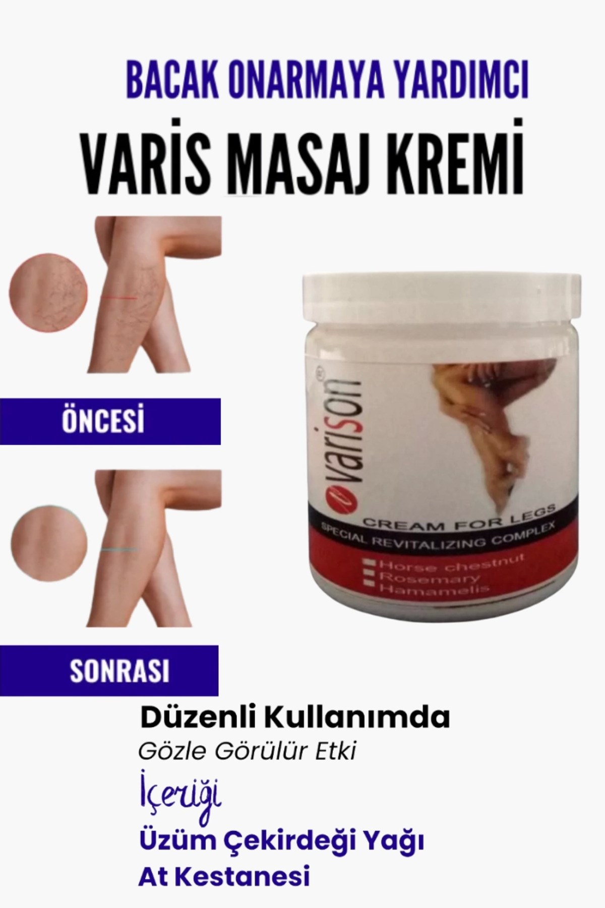 Var.is Bölgesi Için Bacak Onarmaya Yardımcı Ve Besleyici Varison Masaj Kremi 200 ml
