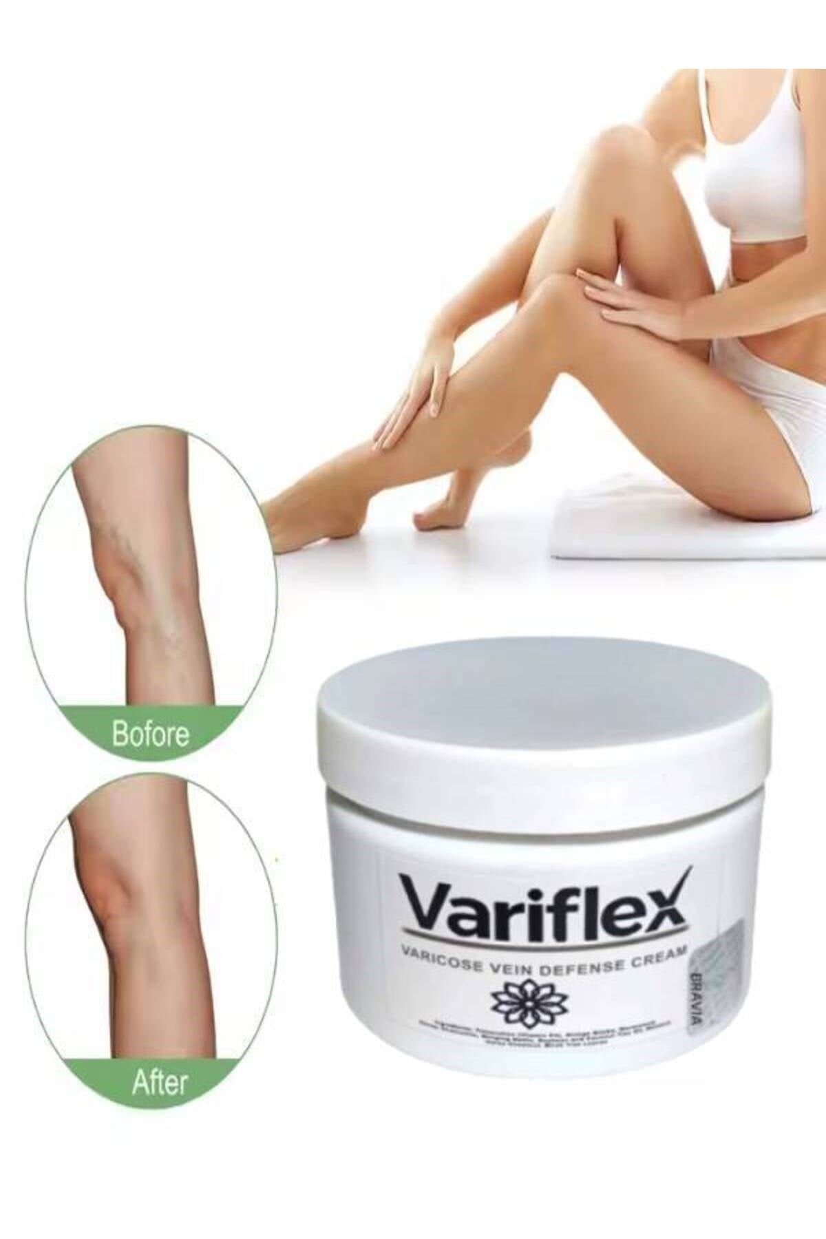 Variflex Kadınlar İçin Varicosel-Selulıt Bakım Creami 150 ml x 1 adet