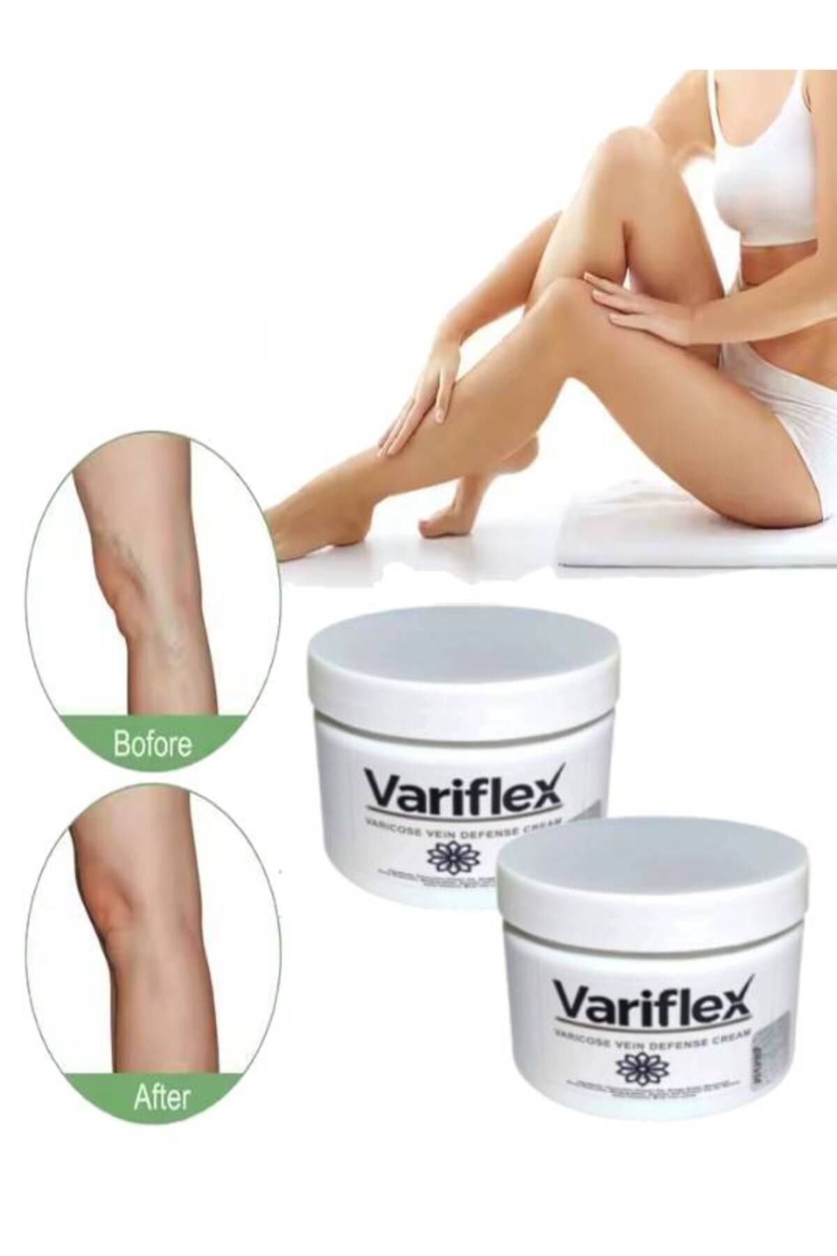 Variflex Varicose Vein Defense Bacak Var.isleri Için Masaj Bakım Kremi 150 ml 2 Adet