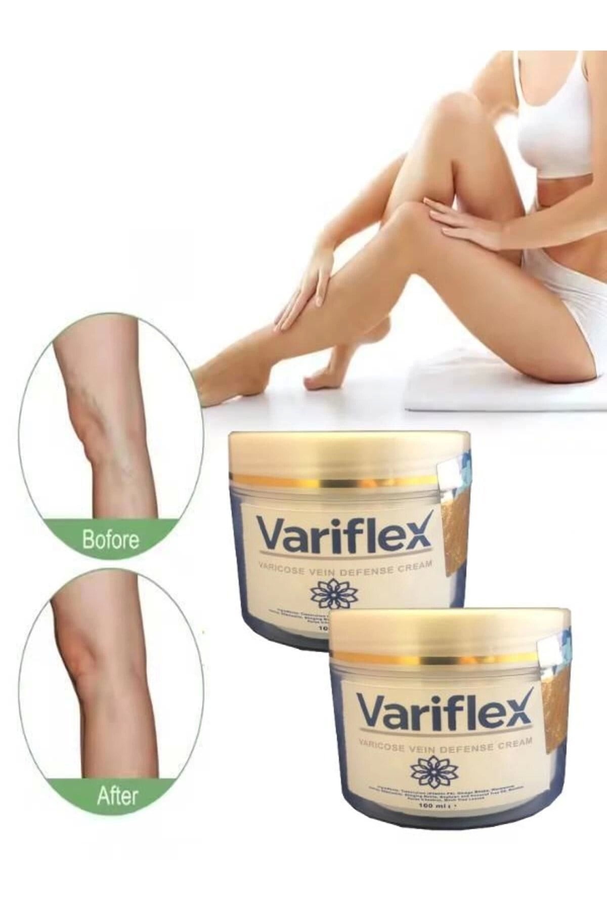 Variflex Varicose Vein Defense Bacak Var.isleri Için Masaj Bakım Kremi 100 ml 2 Adet