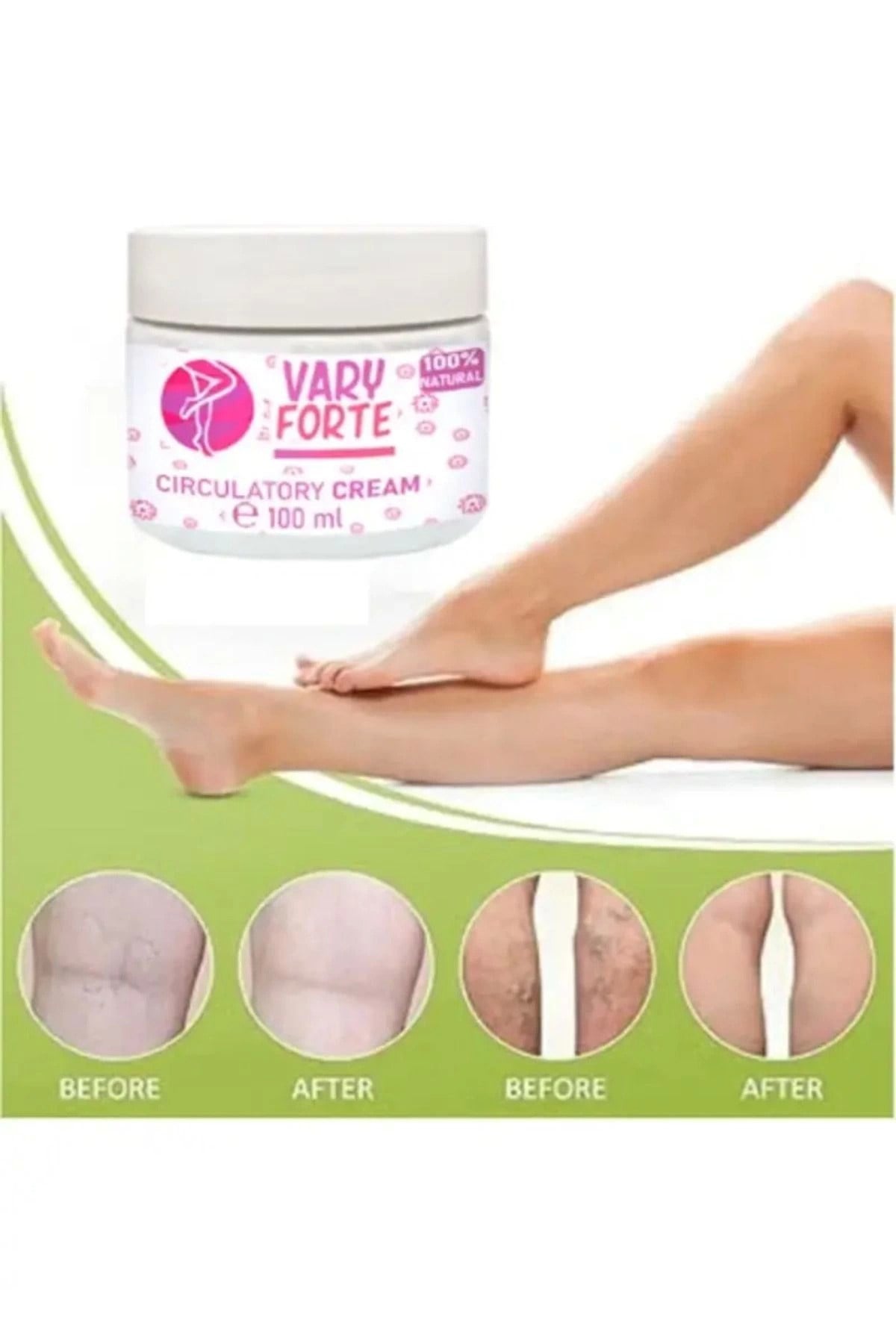 Vary Forte Kavanoz Yoğun Warislere Karşı Tesirli Krem 100 ml