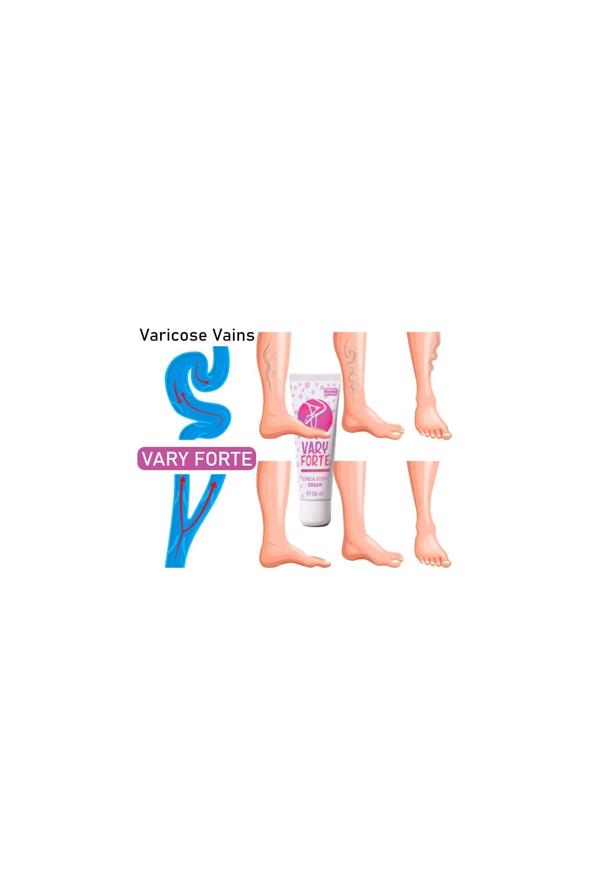 Vary Forte Tüp Krem 100 ml Yoğun Varislerinize Güçlü Tesirli