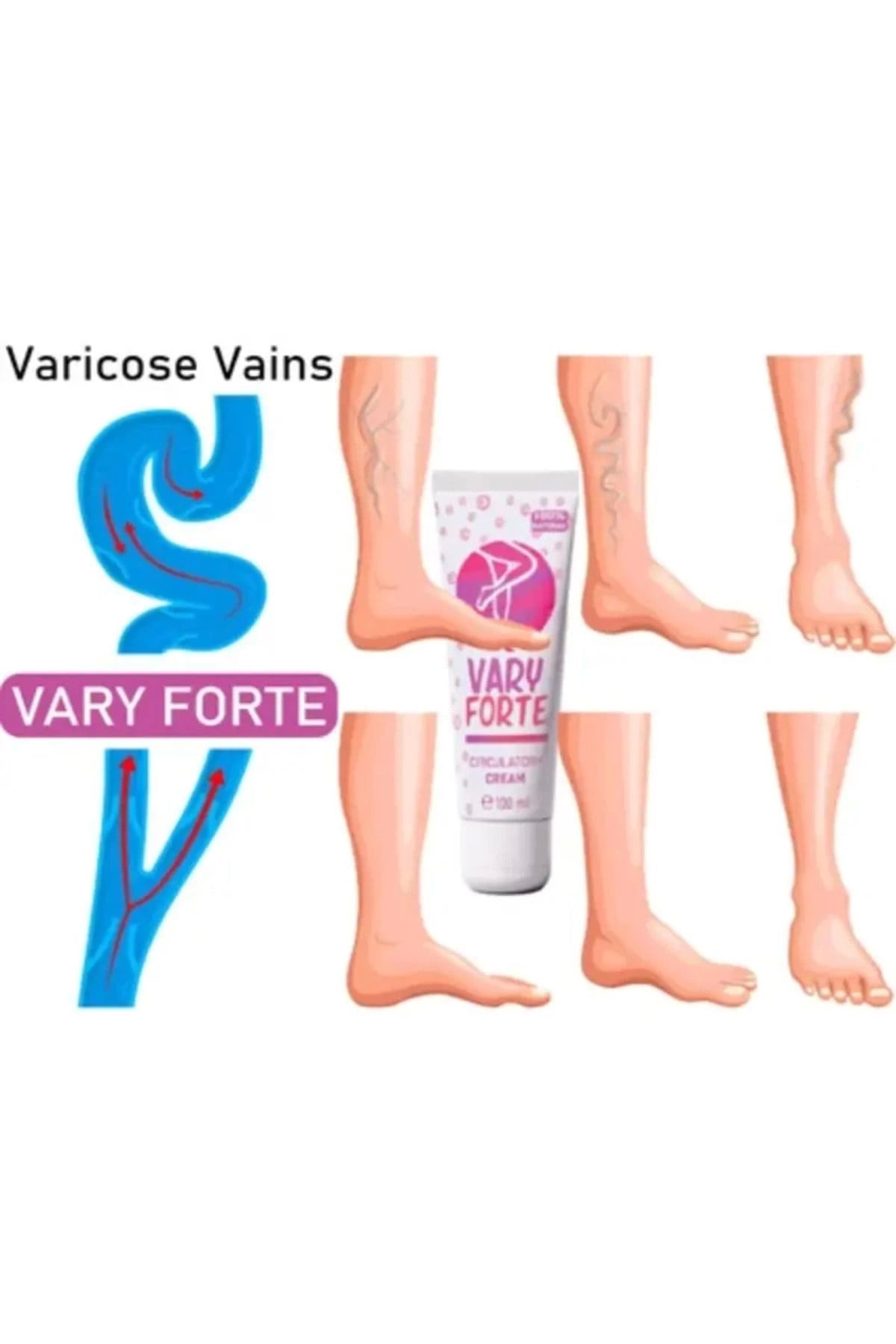 Vary Forte Tüp Yoğun Varislerinize Güçlü Etkide Krem 100 ml 3 ADET