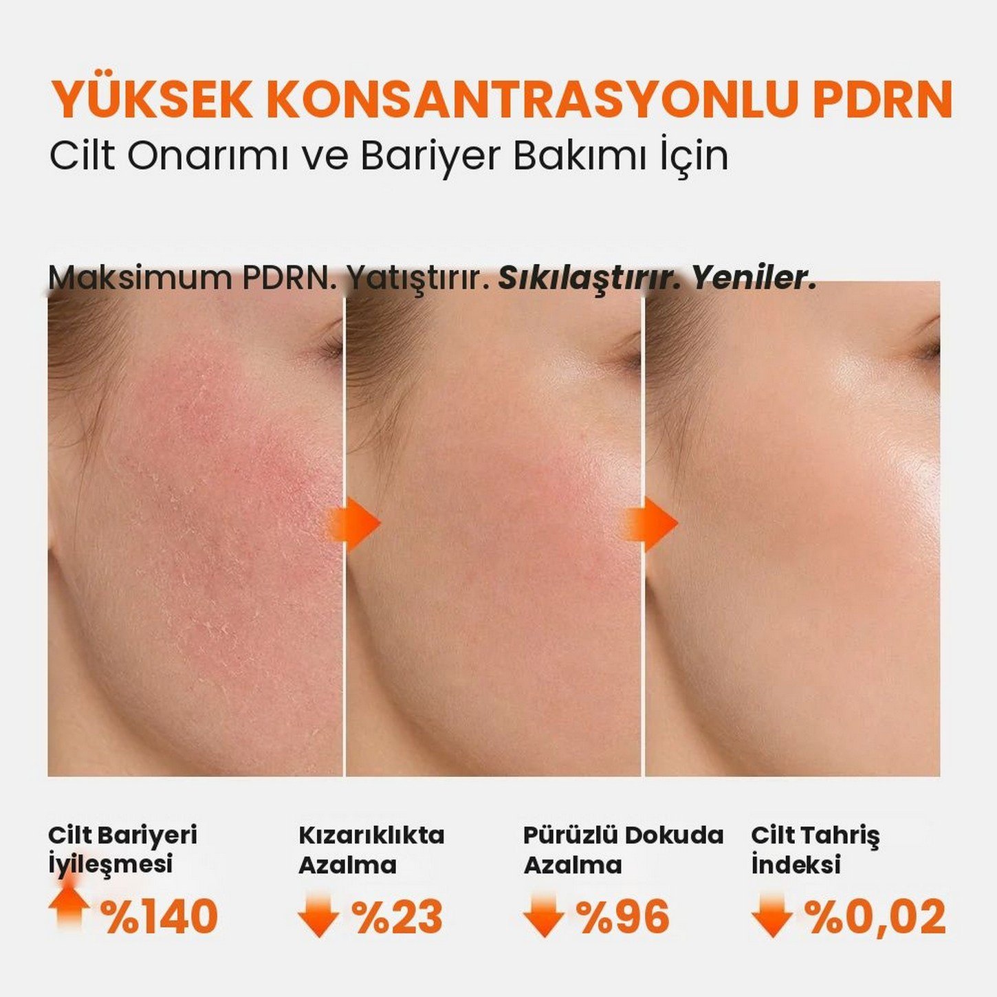 Genabelle PDRN 3% Hyper Boost Ampoule – %3 Somon DNA (PDRN) İçeren Yoğun Hücre Yenileyici Yaşlanma Karşıtı Ampul 40ml